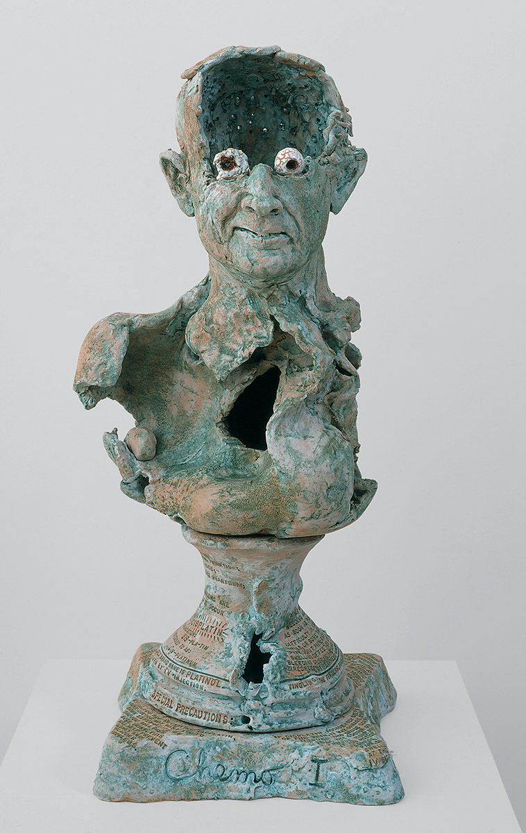 Robert Arneson, Chemo 1, 1992